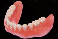 ソフトプレートデンチャー