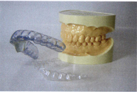 スプリント療法